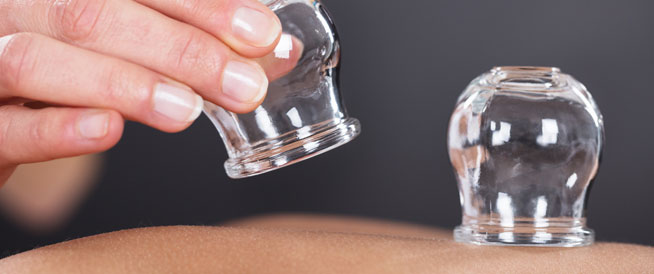 cupping imege